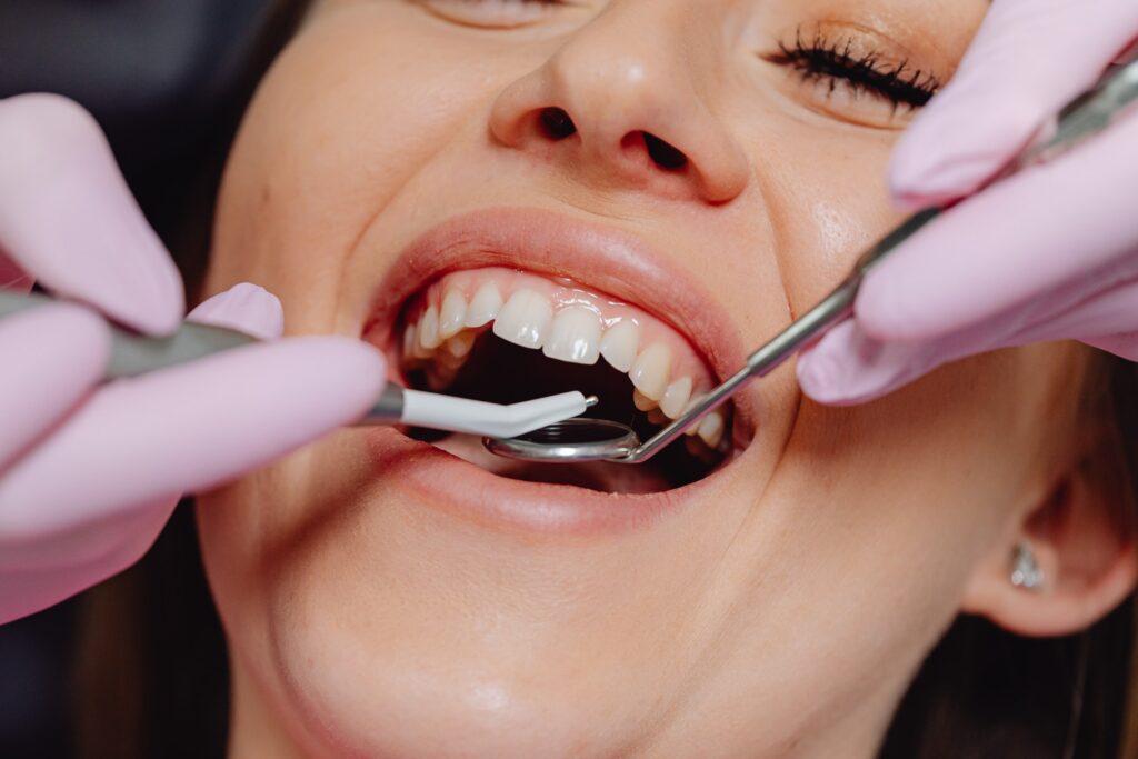 What deficiency causes bleeding gums
